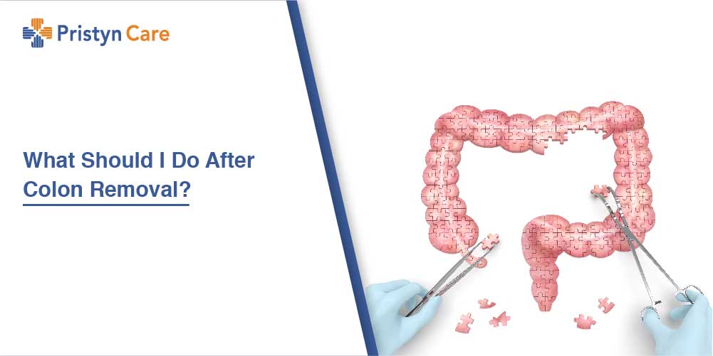 What Should I Do After Colon Removal?