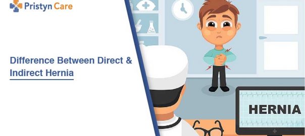 Direct Vs Indirect Hernia