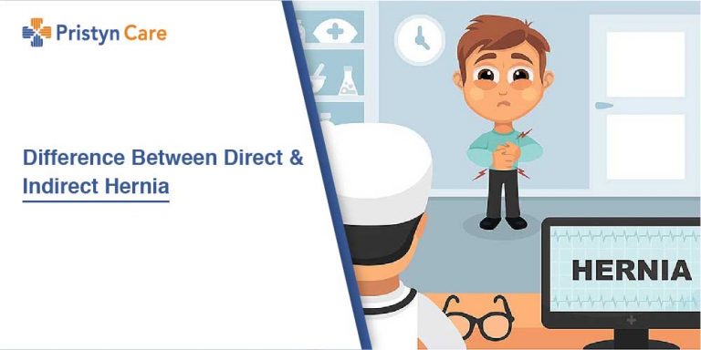 Difference Between Direct And Indirect Hernia