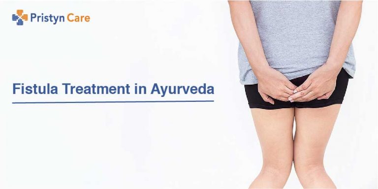 Fistula Treatment in Ayurveda