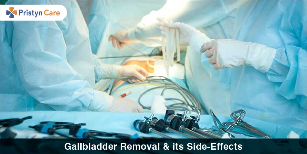 Gallbladder Removal & its Side-Effects