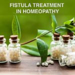 Fistula treatment in homeopath