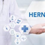 Cover image for dos and donts of hernia