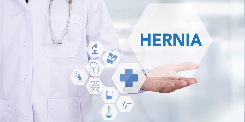 Cover image for dos and donts of hernia