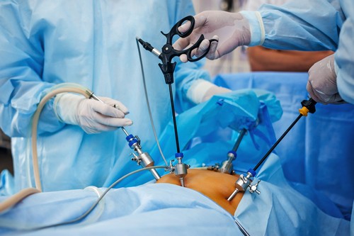 Laparoscopic hernia repair
