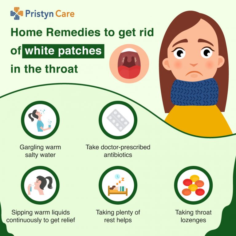 a-must-read-for-white-spots-on-the-throat-doctor-s-advice