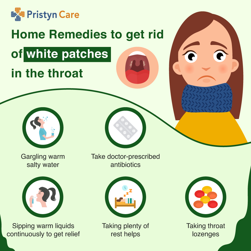 Disappear white will when the throat patches strep from White Spot
