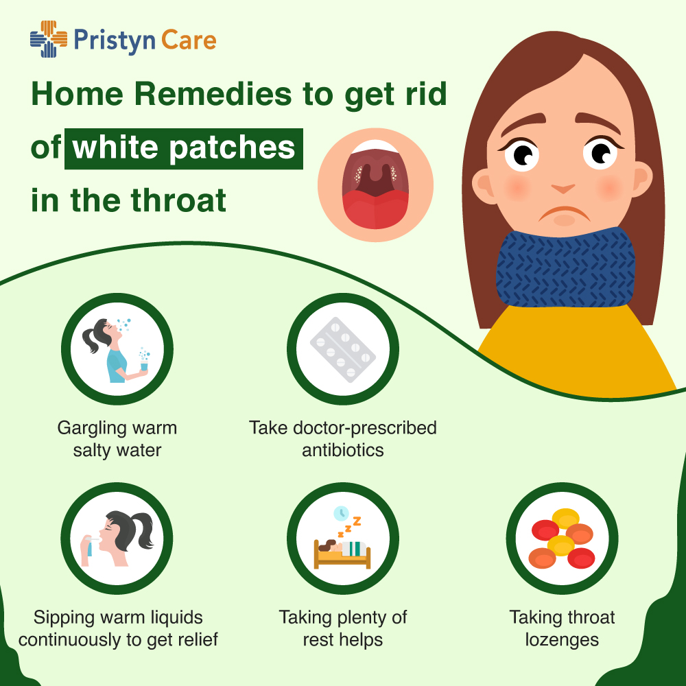 White Spots On Tonsils Treatment