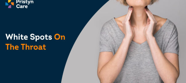 White Spots on the Throat