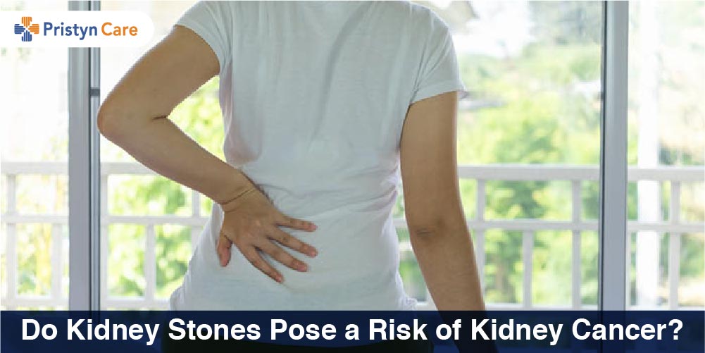 Do Kidney Stones Pose a Risk of Kidney Cancer?