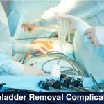 Gallbladder Removal Complications