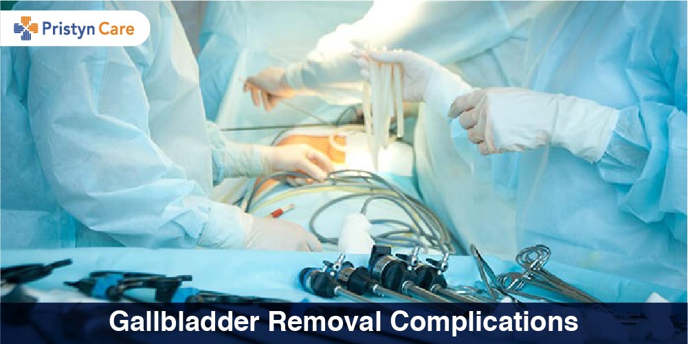 Gallbladder Removal Complications