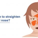 Is it possible to straighten the deviated nose?