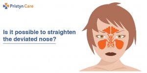 Is it possible to straighten the deviated nose?