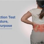 Kidney Function Test (KFT) Procedure, Types and Purpose