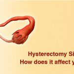 Hysterectomy Side Effects – How does it affect your health?