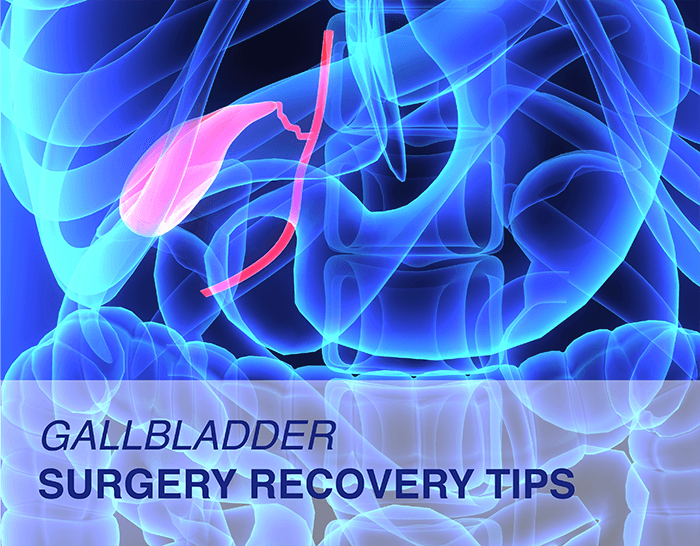Gallbladder Surgery Recovery Tips