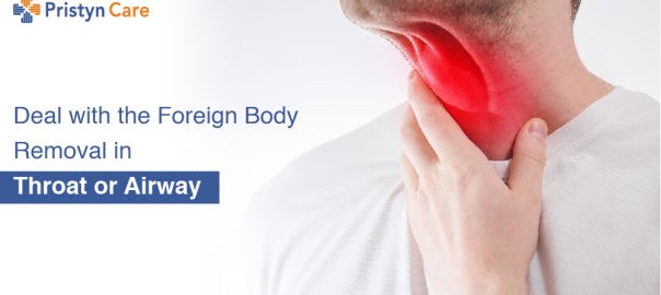 Deal with the Foreign Body Removal in Throat or Airway