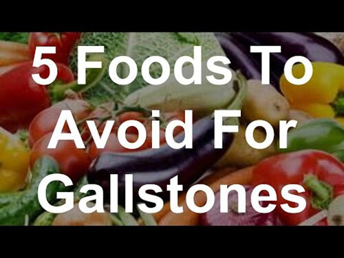 foods to avoid gallstones