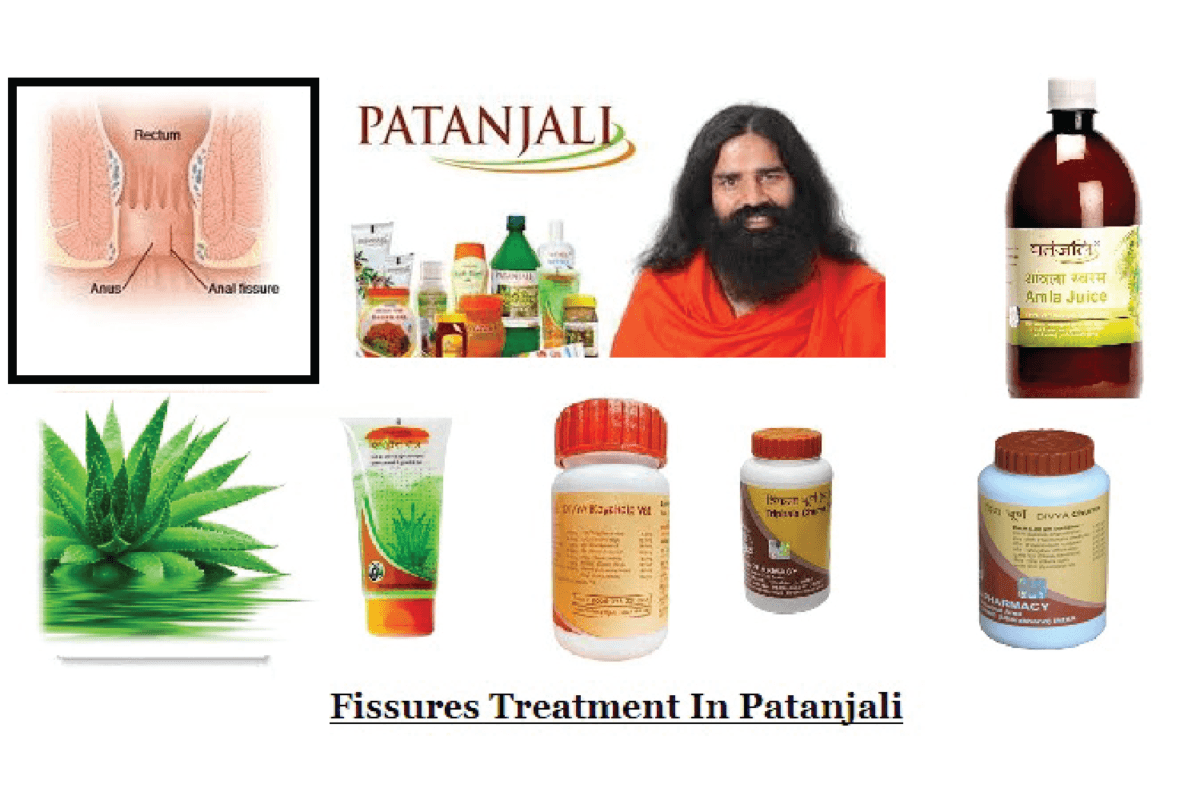 Anal Fissure Treatment options in Patanjali