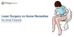 Laser Surgery vs. Home Remedies for Anal Fissure
