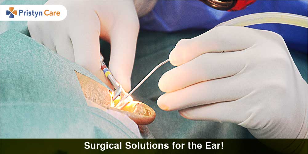 Surgical Solutions for the Ear!