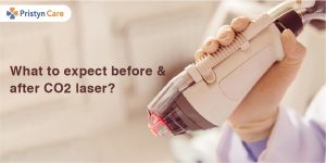 What to expect before and after CO2 laser