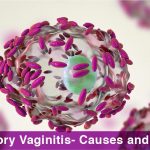 Inflammatory Vaginitis- Causes and Treatment