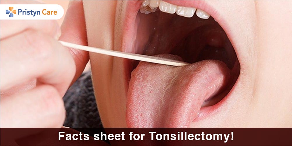 Facts sheet for Tonsillectomy