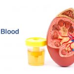 Blood In Urine