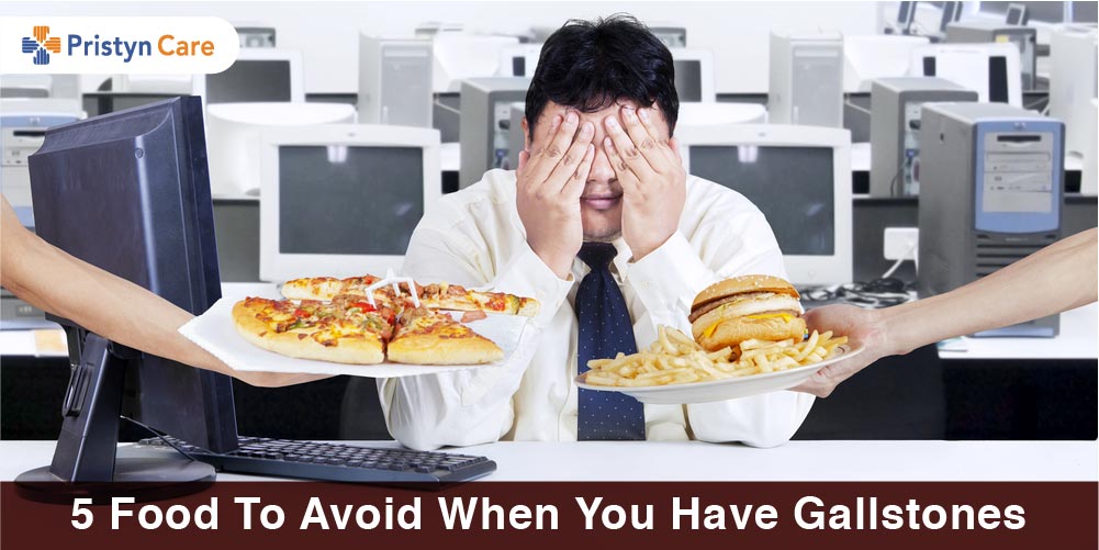 5 Foods to Avoid When You Have Gallstones