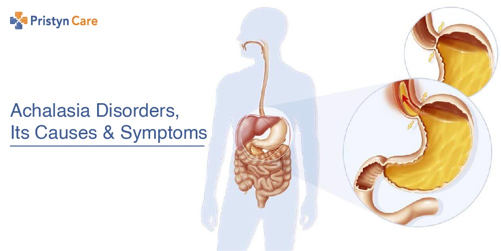 achalasia disorders