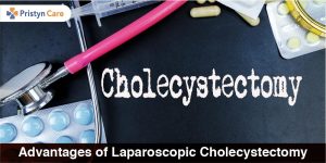 Laparoscopic Cholecystectomy