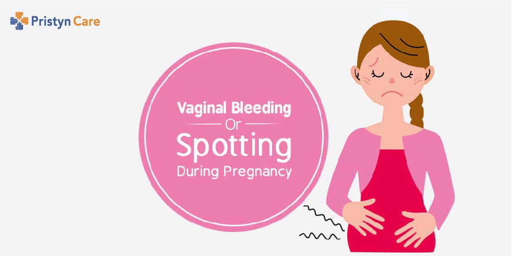 Vagina Bleeding during Pregnancy