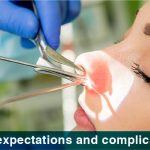 FESS expectations and complications