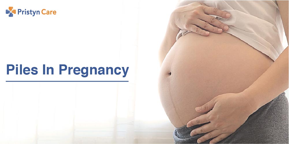 Piles in Pregnancy