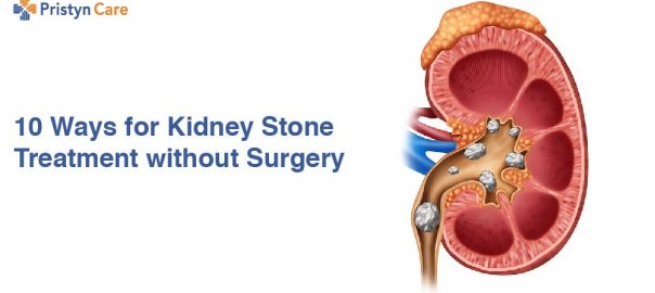 10 Ways for Kidney Stone Treatment without Surgery