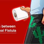 Comparison between Piles and Anal Fistula