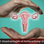 Advantages and disadvantages of hysterectomy or uterus removal