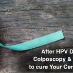 After HPV DNA+ Report, Colposcopy and Cryotherapy to cure Your Cervical Cancer