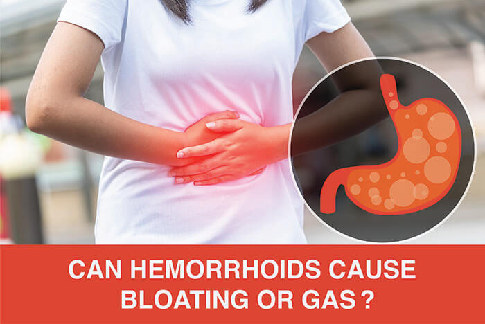 Can Hemorrhoids cause bloating or gas?