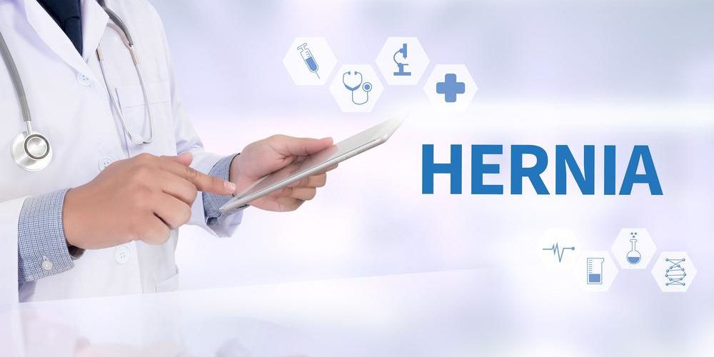 Can Hernia Hamper Your Daily Life,A Doctor’s Guide to Hernia