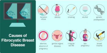 fibrocystic breast changes fibrocystic breast changes
