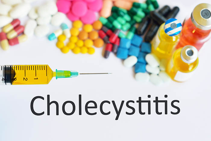 Cholecystitis: Causes, Symptoms, Treatment And Prevention