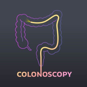 When is the right time to go for a colonoscopy