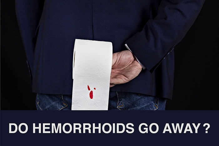 Do hemorrhoids go away