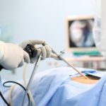How Long Does Laparoscopic Surgery Recovery Take