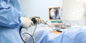 How Long Does Laparoscopic Surgery Recovery Take