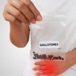 How Prevalent Gallstones Are In India