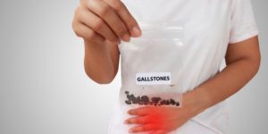 How Prevalent Gallstones Are In India